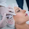 Face Thread Lift: Non-Surgical Facial Lifting and Contouring.